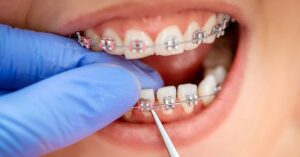 The significance of orthodontic treatment